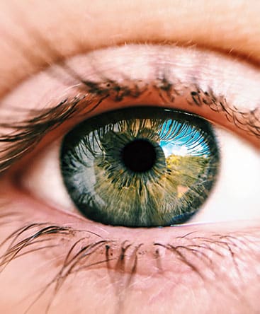 Vision of Green Eyes — Ophthalmologist In Southport, QLD