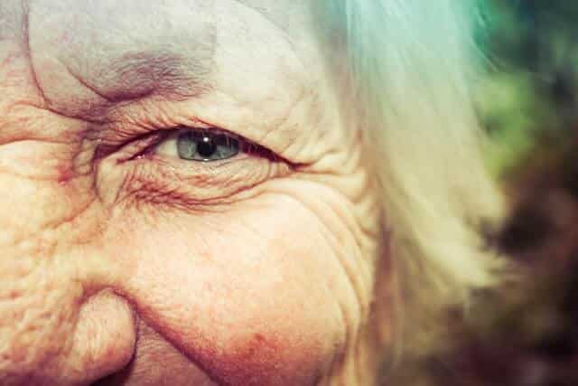 eyes of woman with diabetic retinopathy