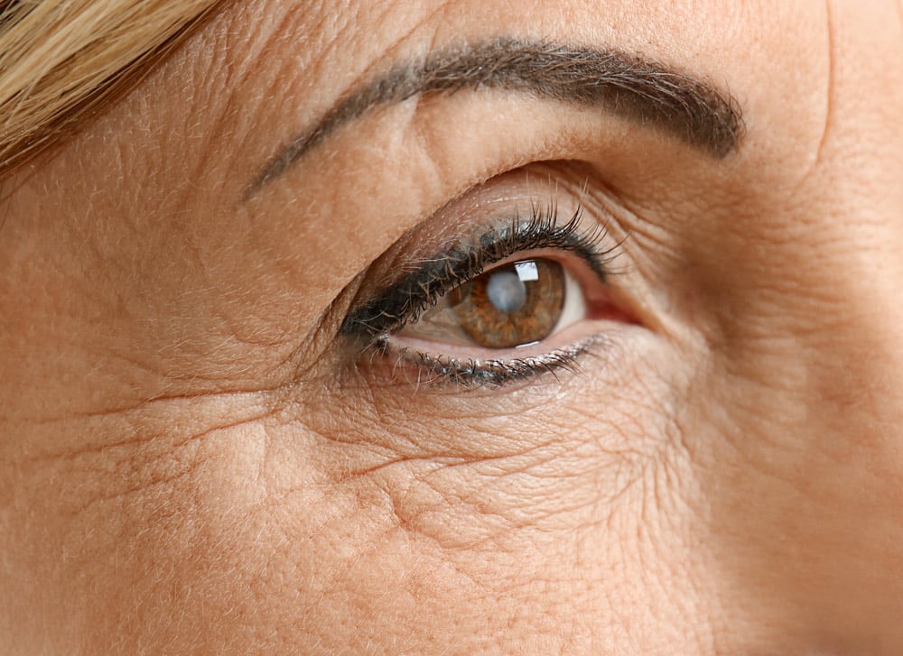 Read more about the article What Are The Three Main Types Of Cataracts?