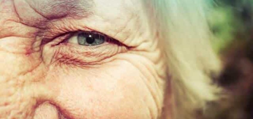 eyes of woman with diabetic retinopathy